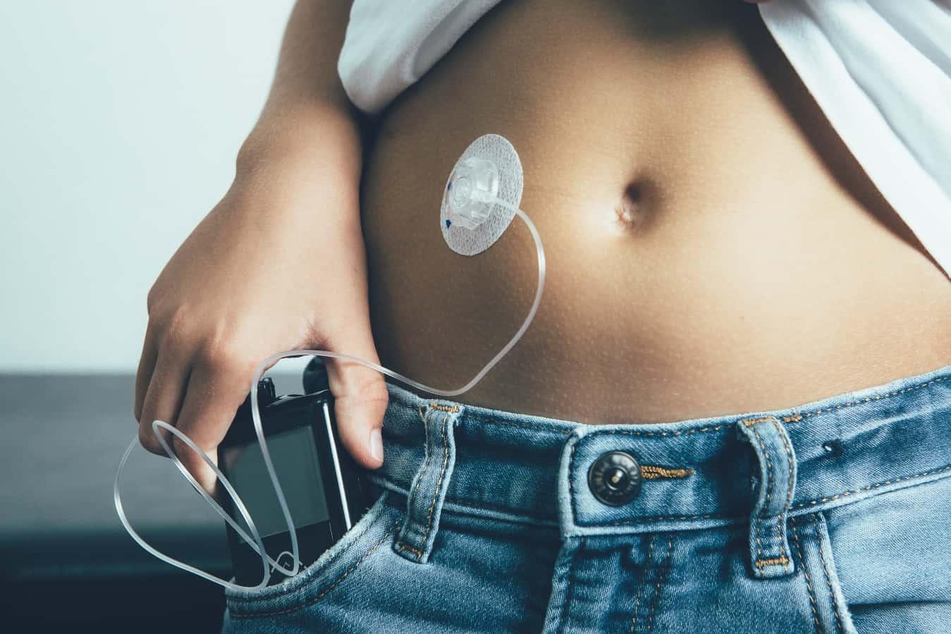 Insulin Pump Price Philippines Insulin Pump Price Philippines